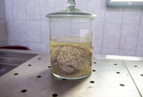 Pig brains kept alive outside bodies for first time