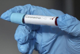  Azerbaijan confirms 315 new coronavirus cases, 5 died 