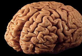 Human brain has higher degree of plasticity