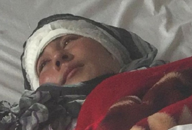 Afghan woman`s ears cut off by husband
