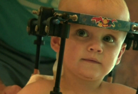 Toddler"s head reattached to spine after car crash - VIDEO