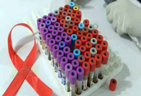 New low-cost printer tracks HIV patients` health