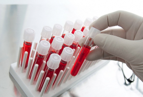 Blood test for cancer gets closer