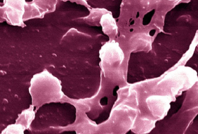 Antibiotics May Make `Superbug` MRSA Stronger