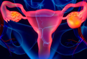 New genetic link reveals some ovarian cancer passed down by fathers
