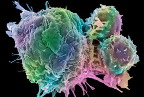 Why some cancers are 'born to be bad'