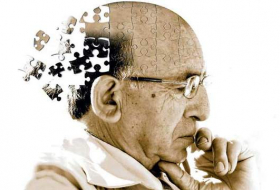 9 surprising risk factors for dementia