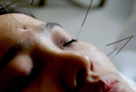 Acupuncture 'no better than placebo for improving IVF success'