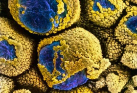 Cause of polycystic ovary syndrome discovered at last