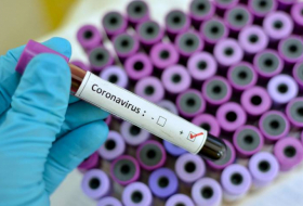  43 more test positive for coronavirus in Azerbaijan 