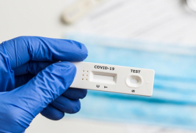  Azerbaijan produces over 20,000 COVID-19 PCR tests   