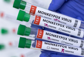   WHO to send Azerbaijan tests for monkeypox virus  