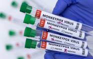  Tests for detection of monkeypox virus transferred to Azerbaijan 