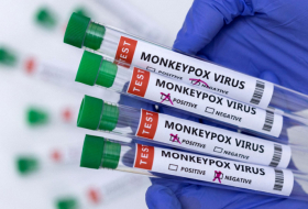  Tests for detection of monkeypox virus transferred to Azerbaijan 