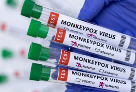   TABIB reveals methods of protection against monkeypox   