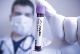 Azerbaijan documents 101 new daily coronavirus cases 