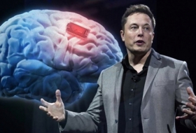   Neuralink implants brain chip in 1st human, says Elon Musk  