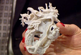 Surgeon Uses 3D Printed Heart To Improve Surgery - VIDEO