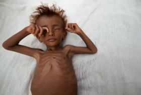 No famine declared in Yemen, but 60 percent on the brink: U.N.-backed report