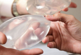 Why thousands of women are having their breast implants removed