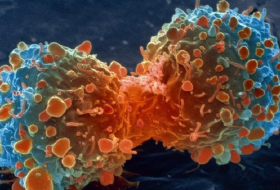 5 Reasons Why The Future Looks Bright For Humans And Bleak For Cancer