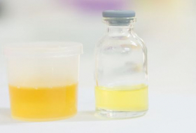 Urine test reveals what you really eat
