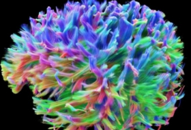 What the brain's wiring looks like