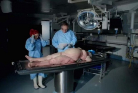 Autopsy on an obese woman found thick butter coloured fat and liver like pate 