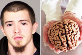 Thief stole HUMAN BRAINS from former insane asylum then sold them on Ebay