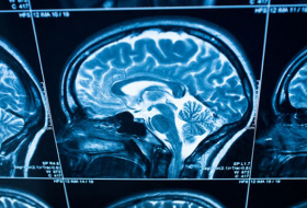 Brain scans could predict patients at risk of major depression