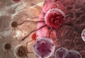 Scientists have found a completely new way to attack and kill cancer cells