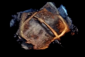 Revolutionary 4D images of human heart - VIDEO