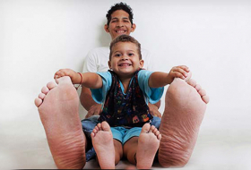 The World`s Largest Feet are Really Huge
