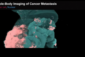Spreading cancer caught on film
