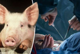 Pig-to-human organ transplant ‘two years away’
