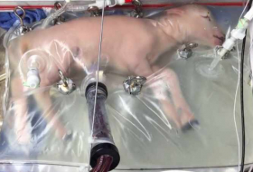 Researchers Have Successfully Grown Premature Lambs in an Artificial Womb