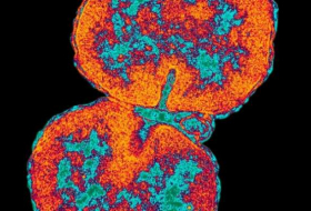 Untreatable gonorrhoea 'superbug' spreading around world, WHO warns