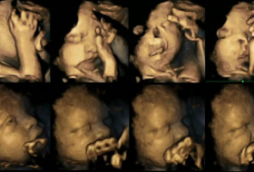 Ultrasounds show fetuses react to mothers` smoking